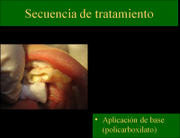 /album/fotogaleria/c19-png/