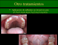 /album/fotogaleria/c22-png/