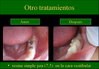 /album/fotogaleria/c24-png/