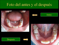 /album/fotogaleria/c26-png/