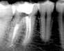 Endodoncia